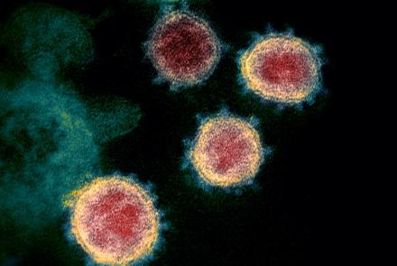 A virologist answers questions on coronavirus transmission: asset-mezzanine-16x9